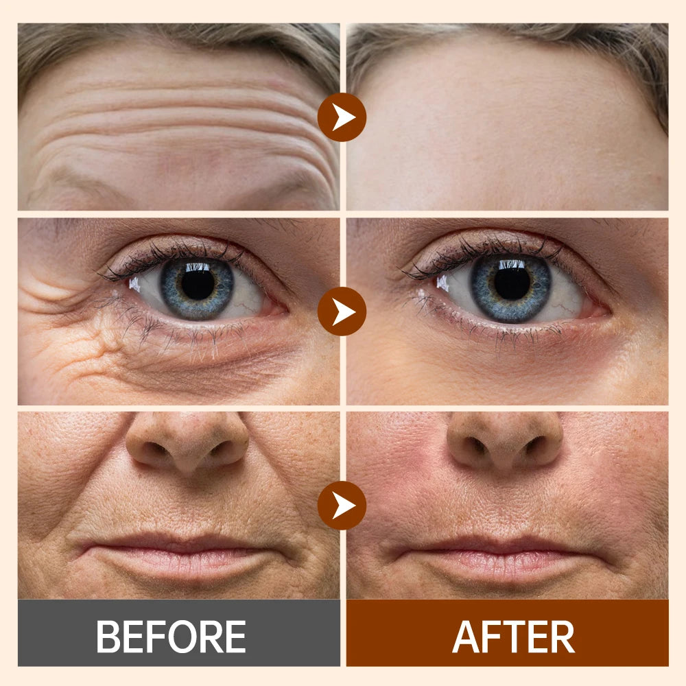Crème anti-âge JOYPRETTYIN