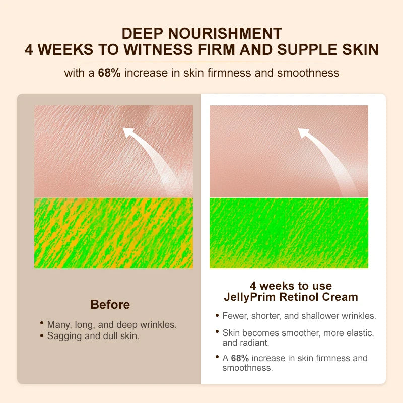 Crème anti-âge  JOYPRETTYIN