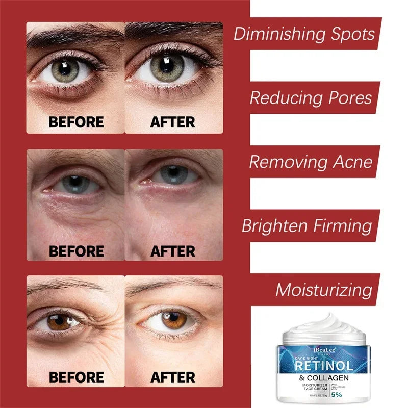 Crème de visage anti-rides