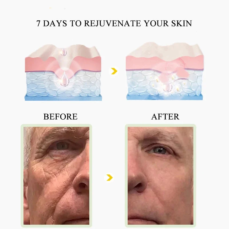 Crème de visage anti-rides