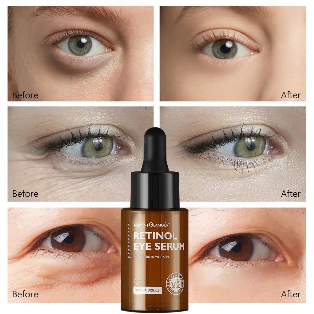 Crème anti-âge